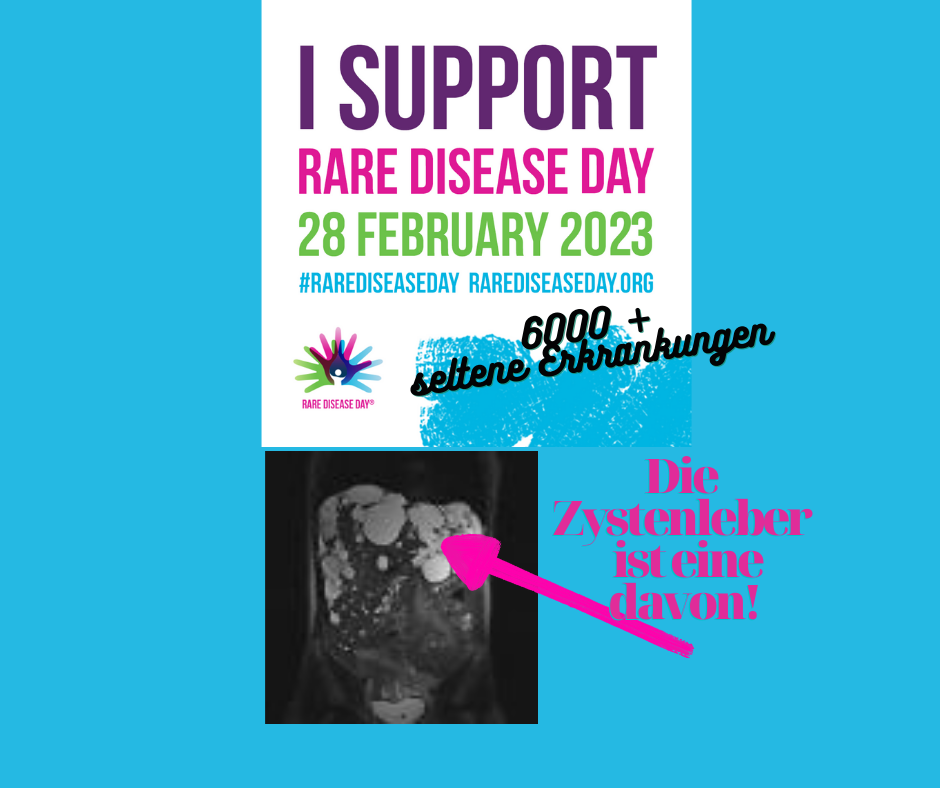 Die Zystenleber- seltene genetische  Lebererkrankung! Rare Disease Day 2023.